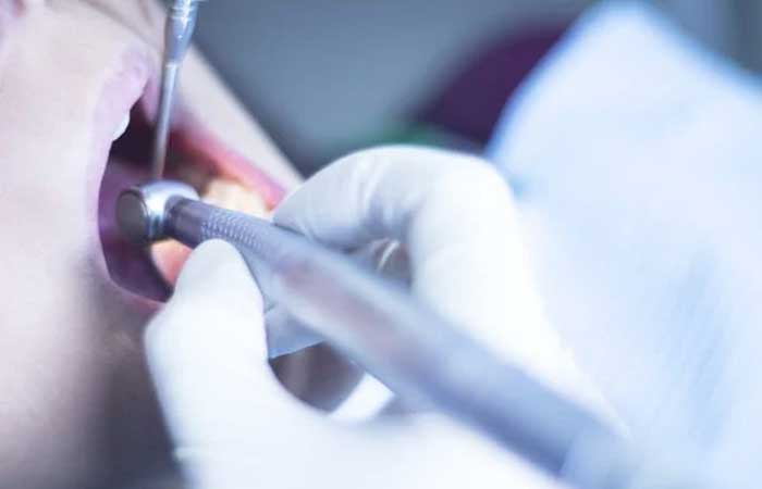 Dentista lista 7 sinais da diabetes que podem aparecer na boca