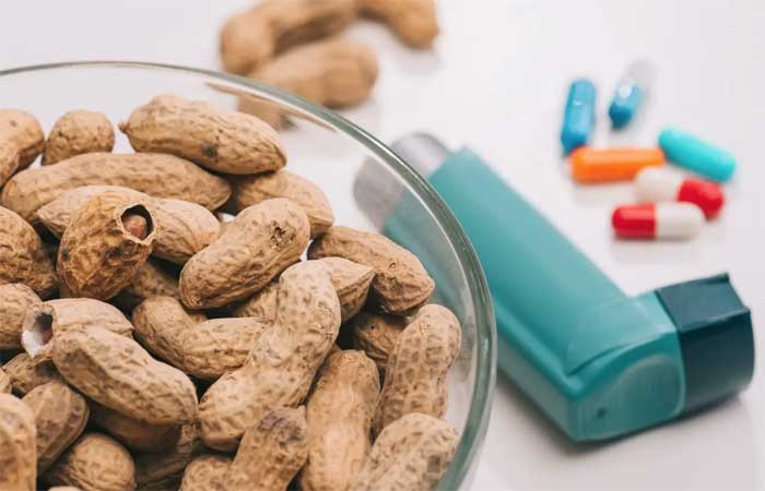 Alergias alimentares: a cura pode vir das boas bactérias do intestino
