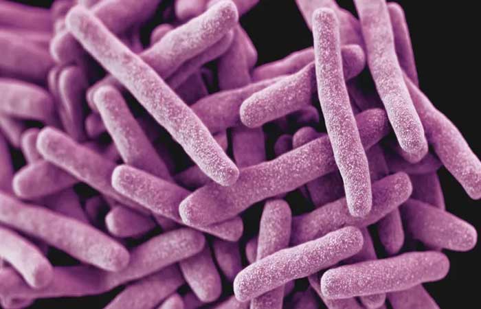 Bactéria rara e mortal é encontrada nos Estados Unidos e gera alerta nacional