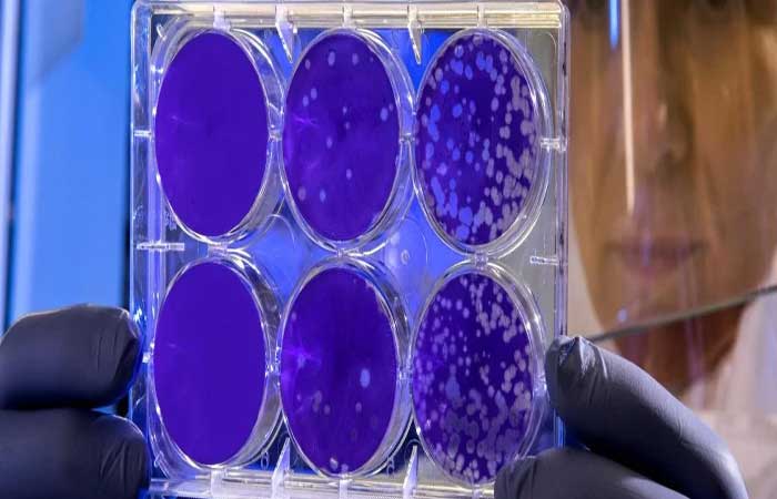 Novo composto pode combater mais de 200 tipos de superbactérias