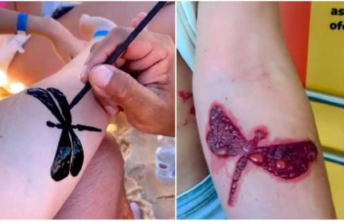 Especialista alerta sobre riscos das tatuagens de henna