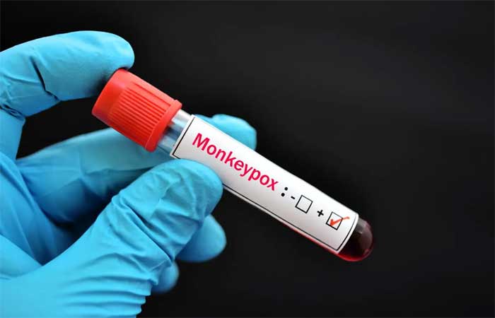 Ministério da Saúde vai começar a vacinar contra varíola dos macacos no dia 13