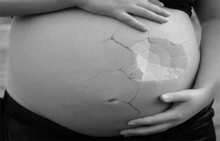 Queimadas aumentam em até 31% a chance de um bebê nascer prematuro na região Sudeste