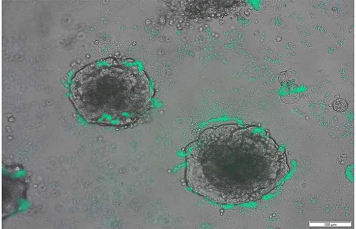 Bactérias ‘treinadas’ poderão caçar o câncer dentro do corpo, mostra novo experimento