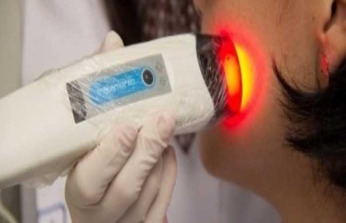 SUS aprova uso de nova tecnologia para tratar câncer de pele