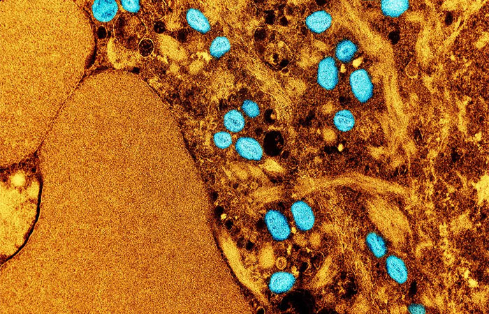 Mpox: saiba quais são os sintomas e formas de transmissão da doença