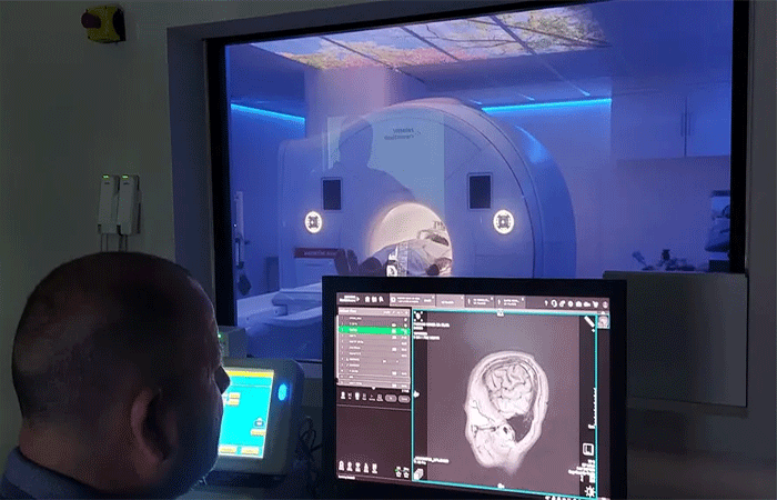 Estudo mostra precisão de até 86% no uso de IA para detectar tumores cerebrais; especialista avalia