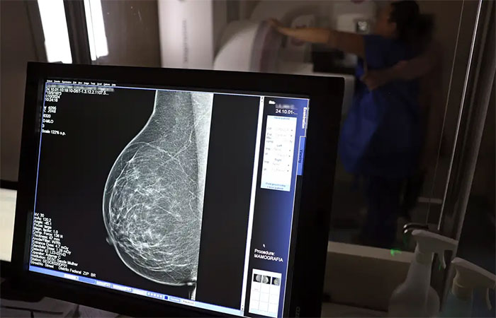 Falta de acesso a mamógrafos limita prevenção do câncer de mama