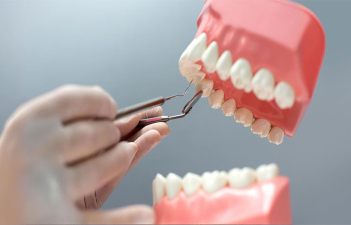 Cerâmica com material reciclado é opção para próteses dentárias mais acessíveis