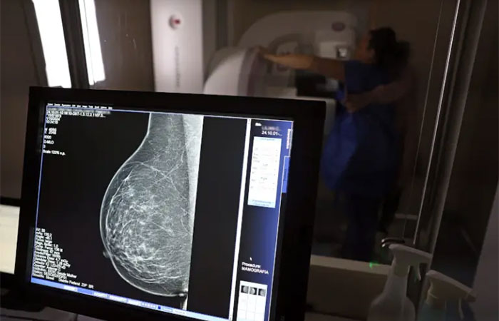 Medo, dor, vergonha e desigualdades afastam mulheres do rastreamento do câncer de colo do útero e de mama