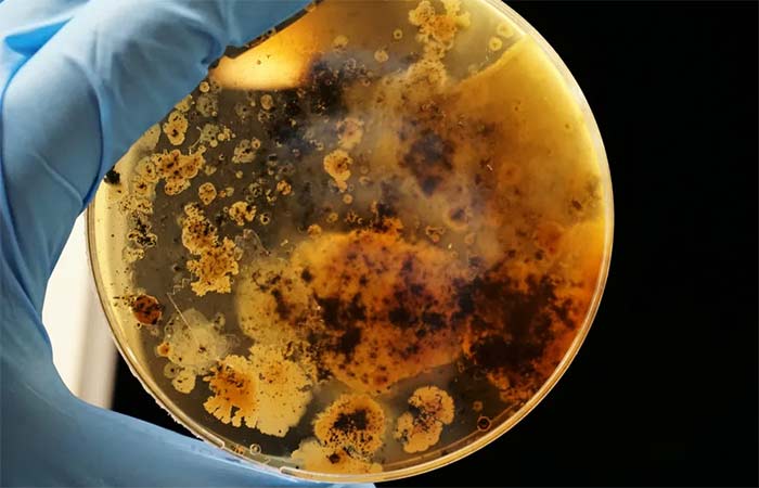 ‘Bactérias resistentes são um importante problema de saúde pública no Brasil’, diz infectologista