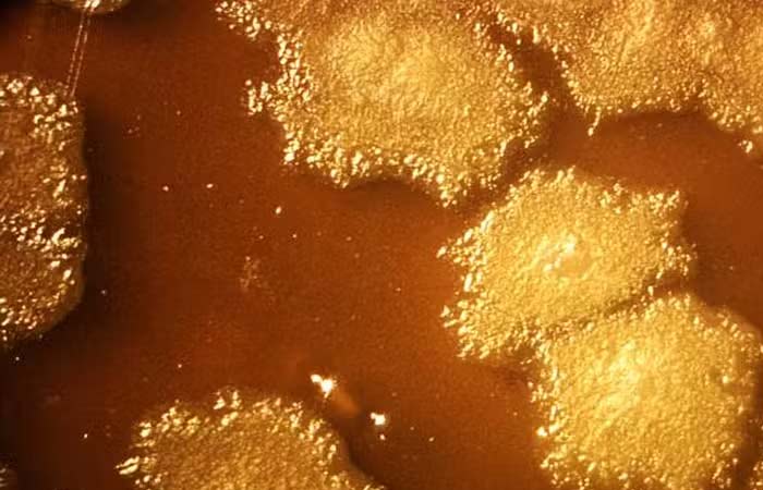 Cientistas testam bactéria que pode acabar com o câncer se alimentando dos tumores