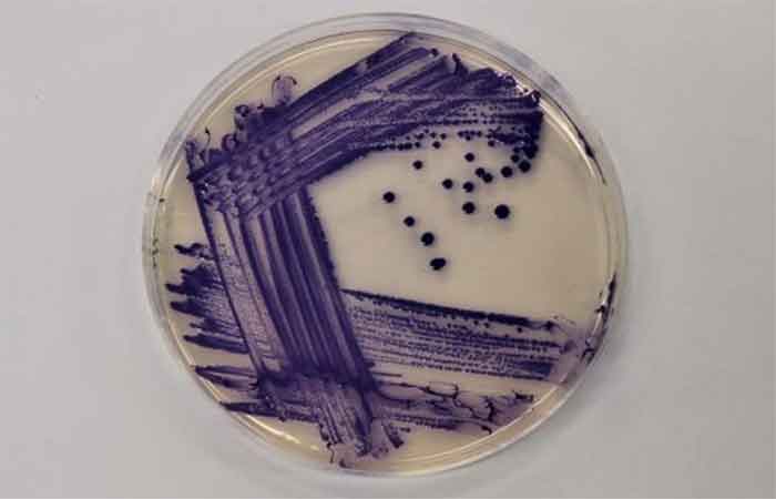 Toxina produzida por bactéria pode inspirar tratamentos inovadores para infecções