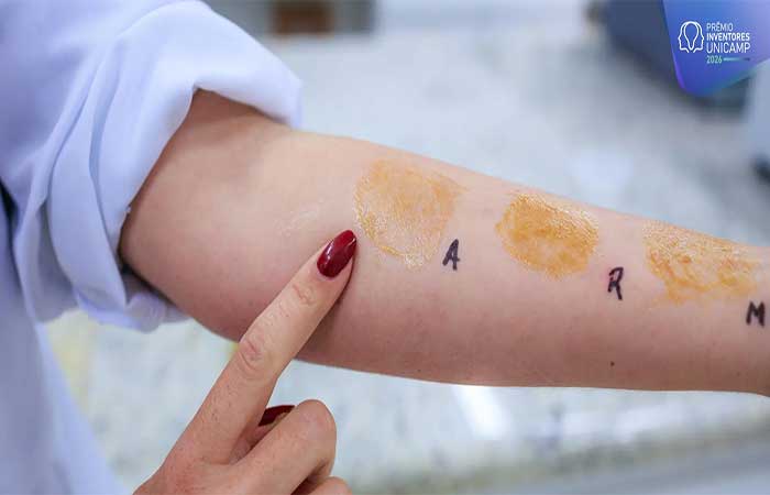 Com biotecnologia verde, empresa-filha da Unicamp avança no desenvolvimento de curativo líquido
