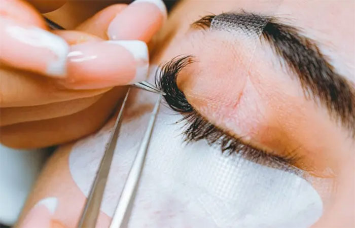 Extensão de cílios pode gerar irritação ocular, obstrução das glândulas e aparecimento de ácaros