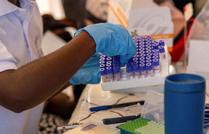 Língua eletrônica detecta gripe aviária em seis minutos